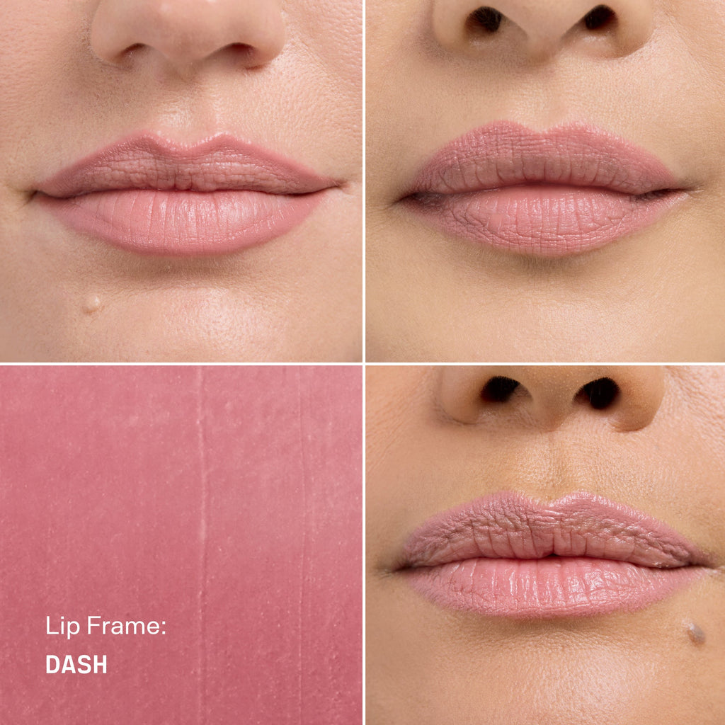 Lip Frame